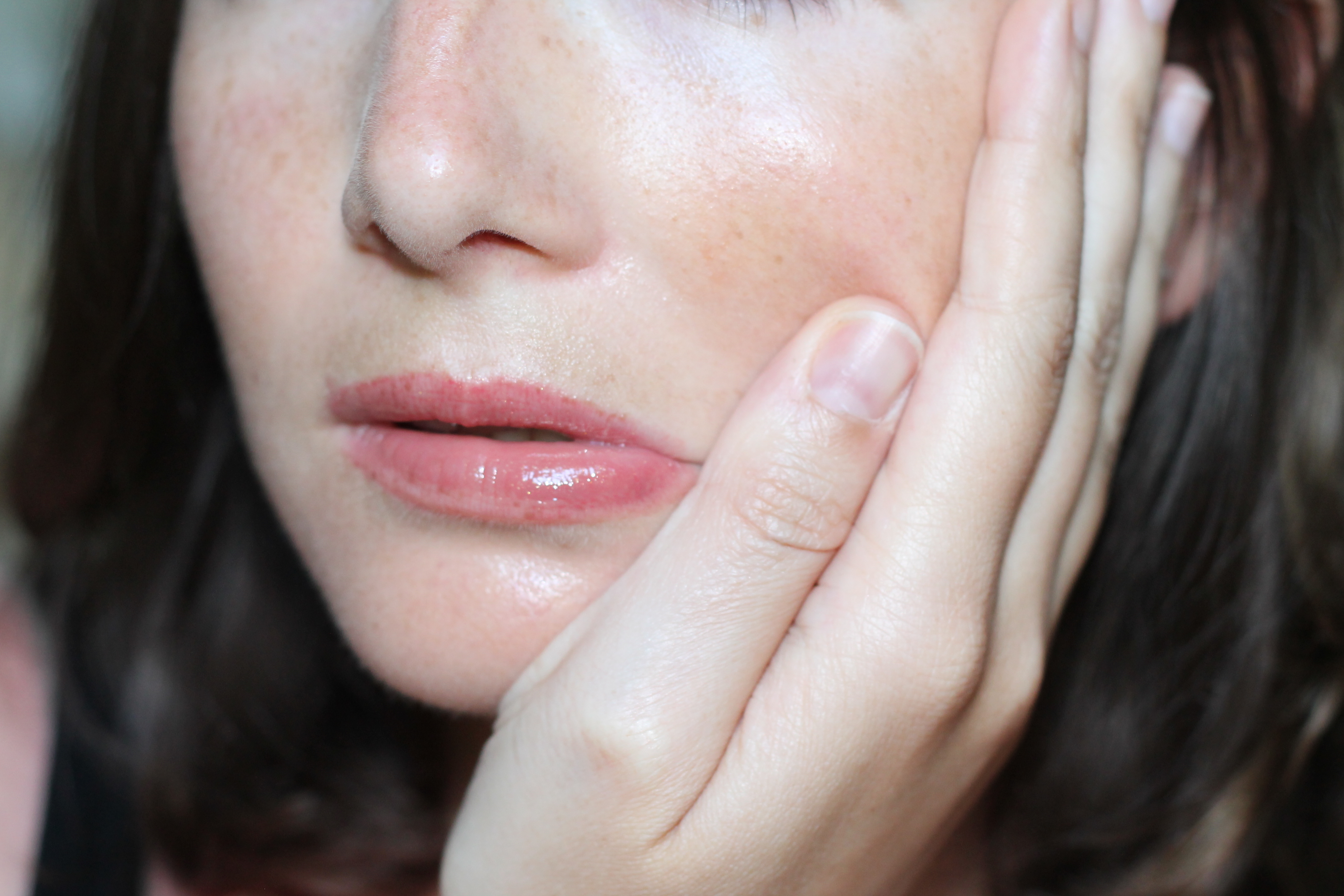 Косметологические методы лечения пигментные пятен на лице
