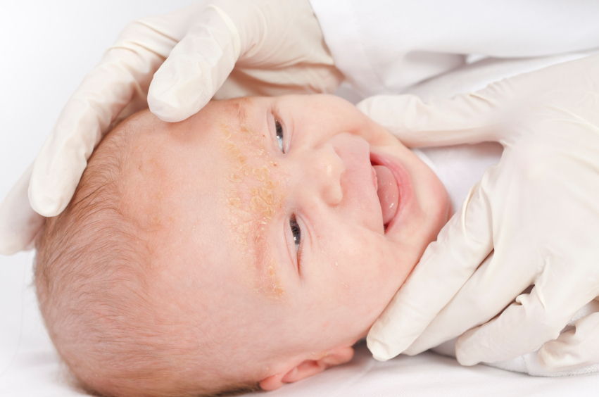 Профилактика шелушения кожи у новорожденного ребенка