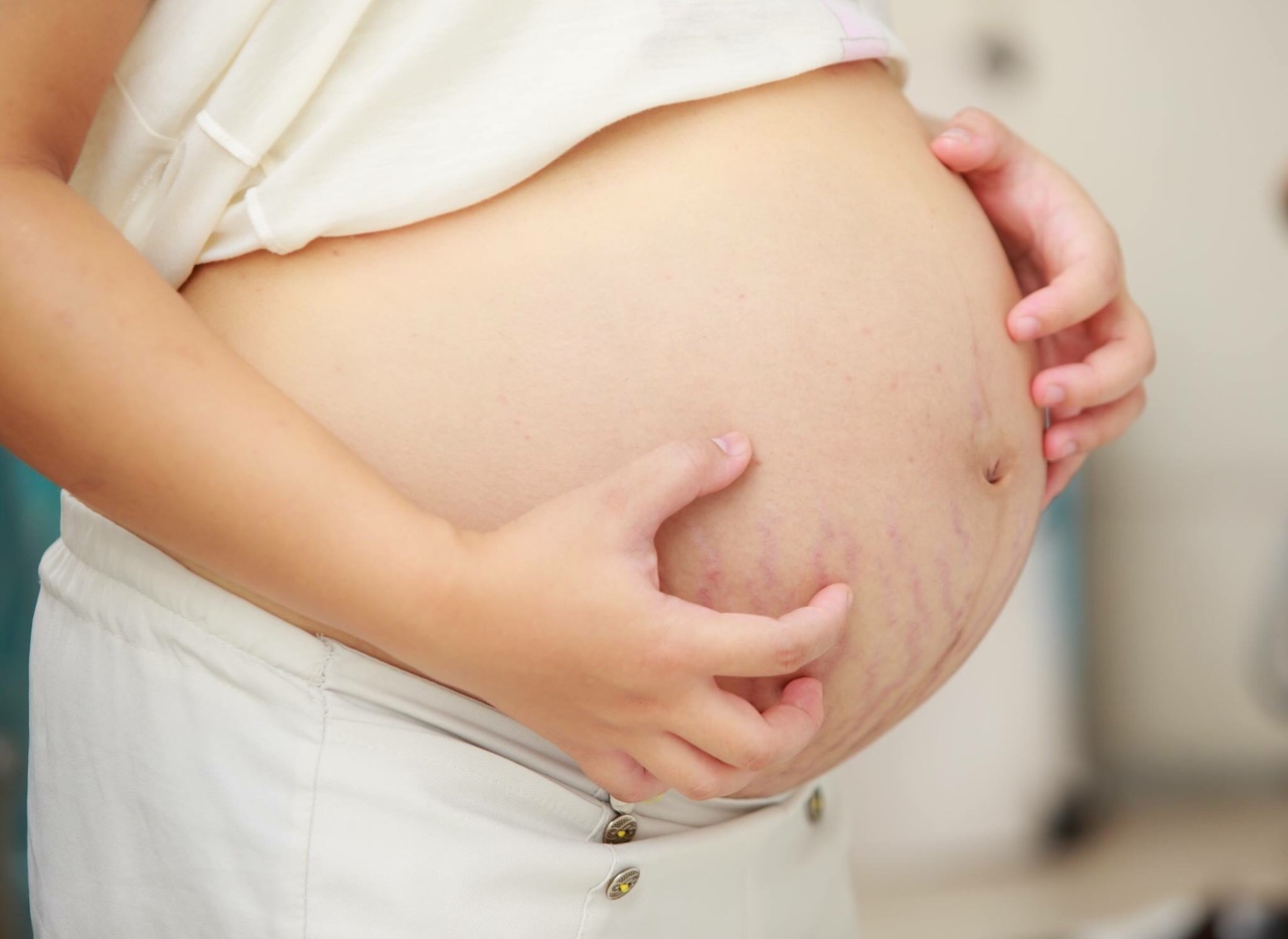 Дерматит во время беременности: виды и симптомы