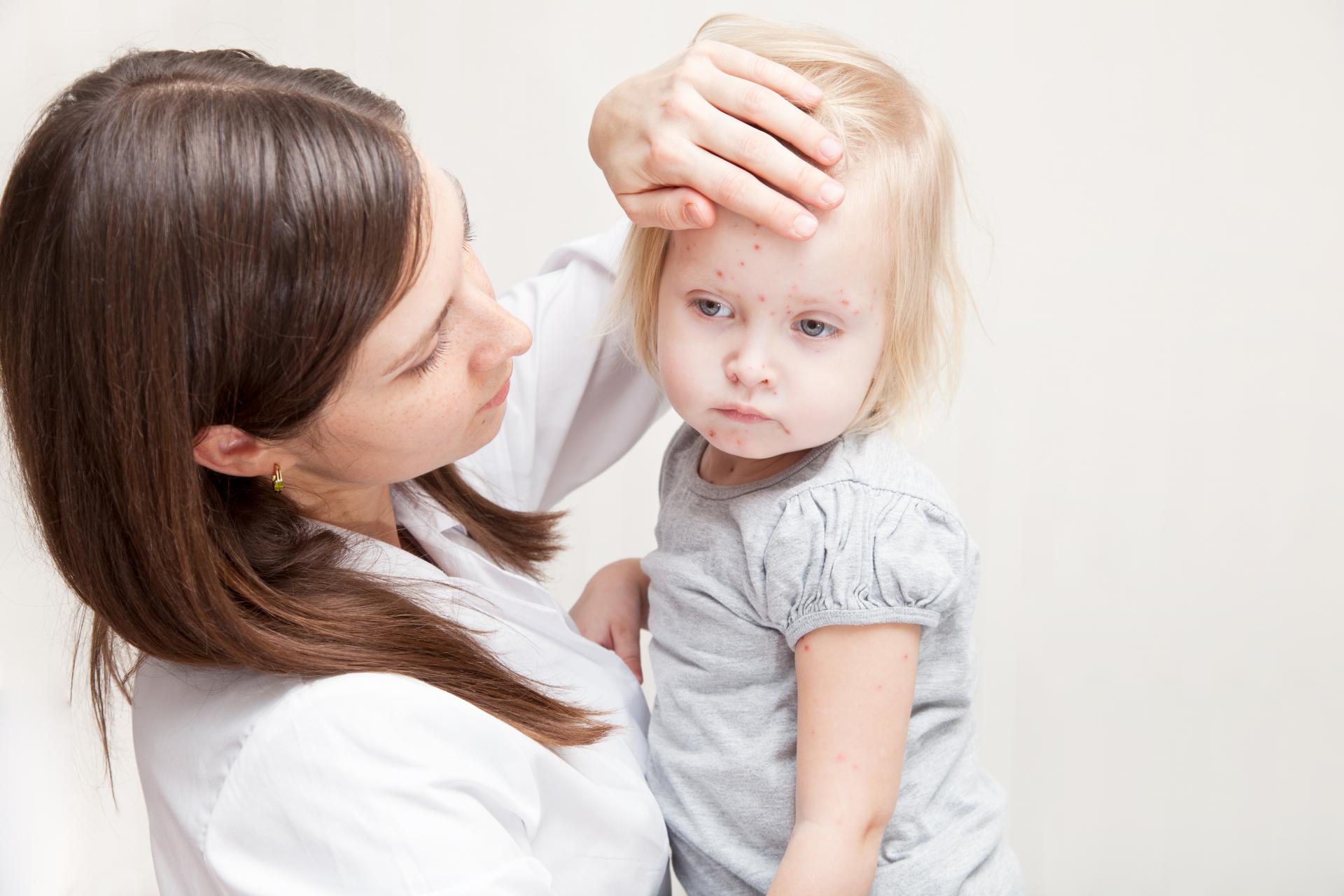 Как лечить кашель при ветрянке у взрослых и детей?