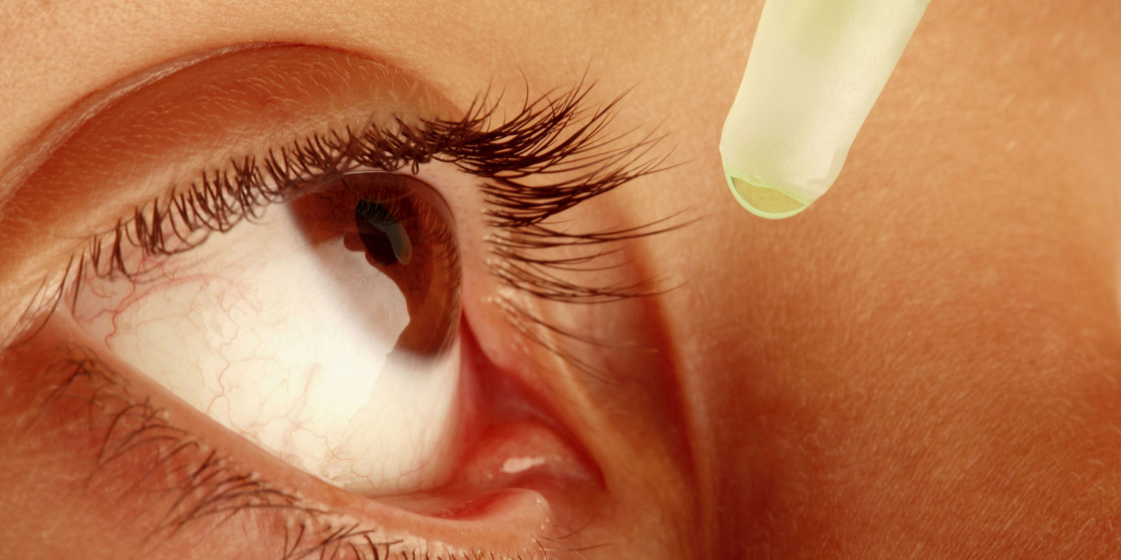 Глазной грибок: лечение - 2