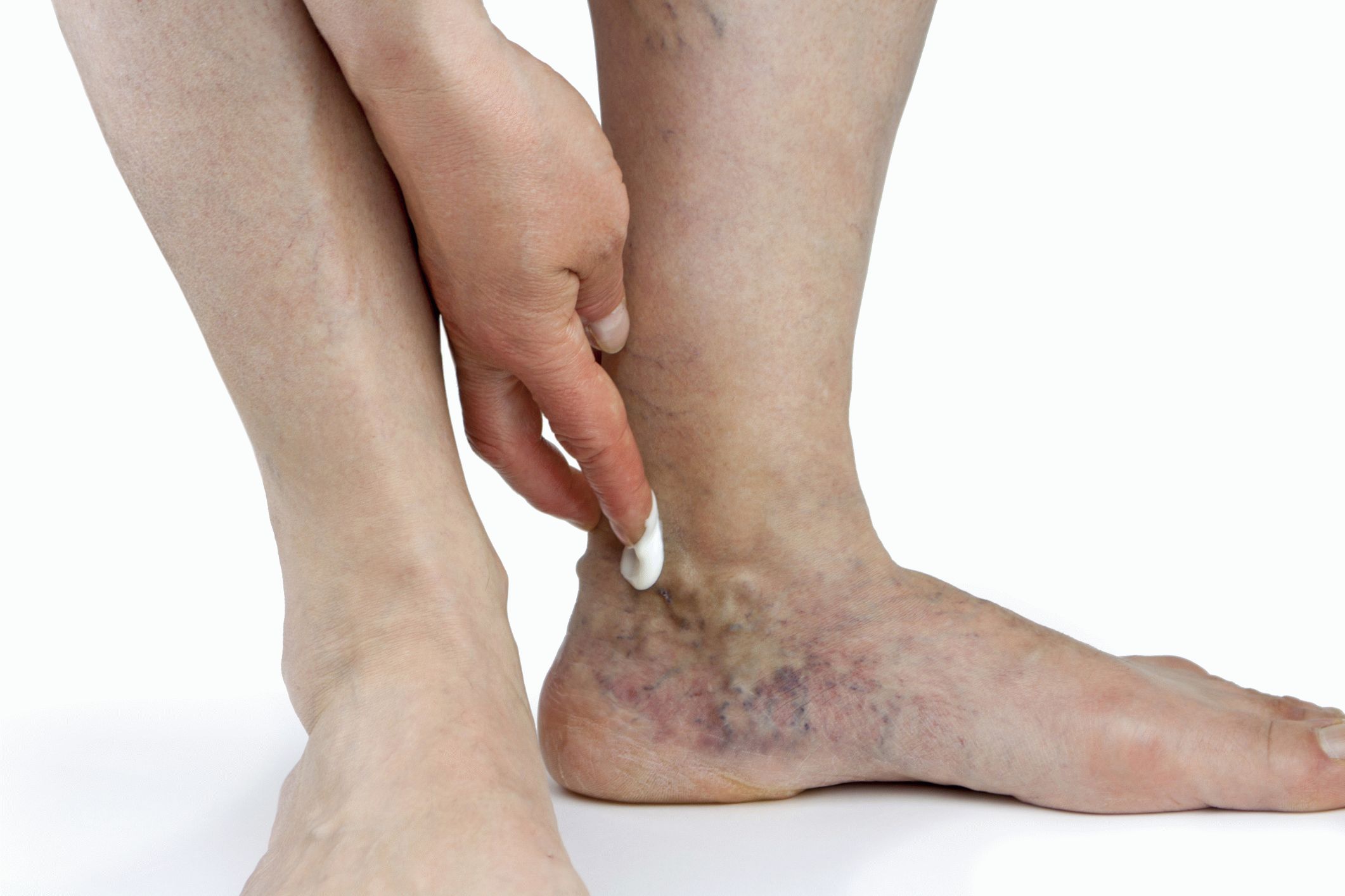 Профилактика появления болей в ногах