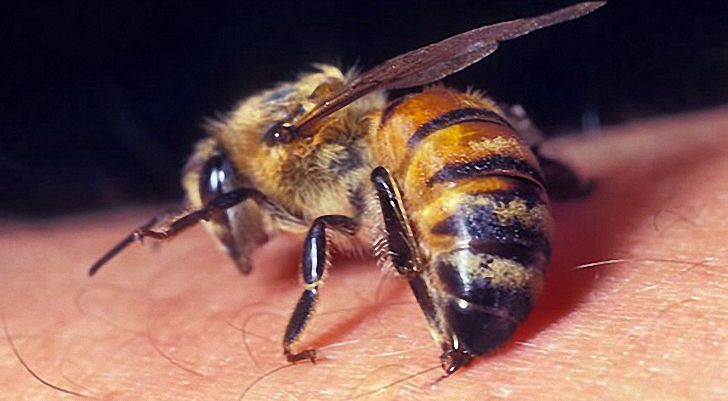 Противопоказания к исцелению варикоза кусанием пчел