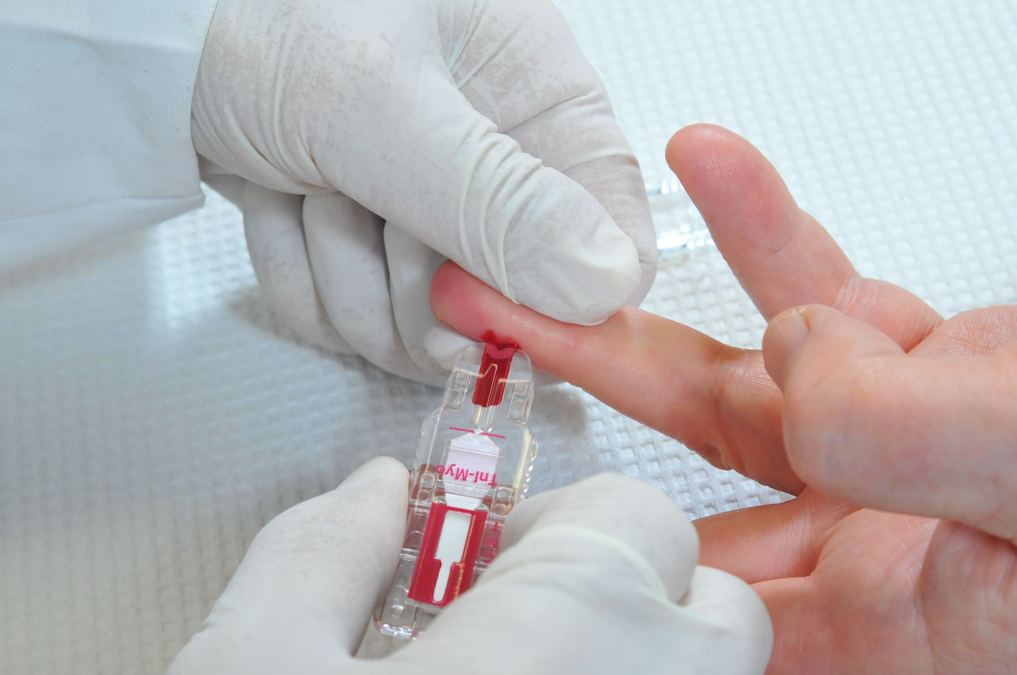 Прививка от ротавируса как мера профилактики
