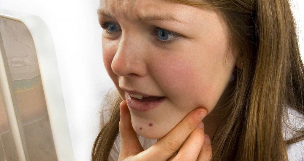 Причины появления угревой сыпи на лице